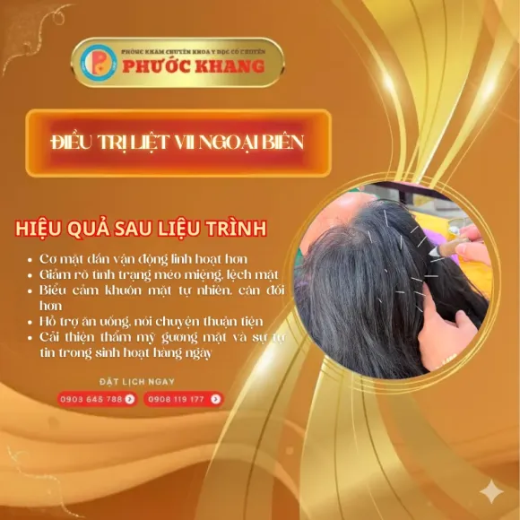 ĐIỀU TRỊ DI CHỨNG SAU TAI BIẾN