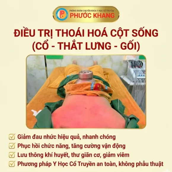 ĐIỀU TRỊ DI CHỨNG SAU TAI BIẾN